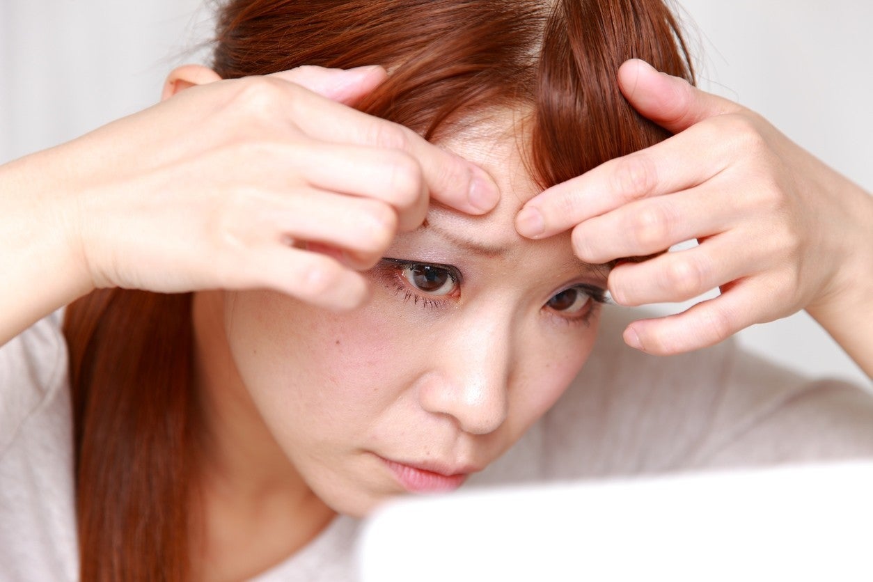 眉間にニキビができる原因は何 ニキビを防ぐオススメ習慣 ローヤル美研